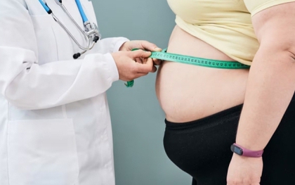 Tăng 35 kg trong một năm do 'ăn để xả stress'
