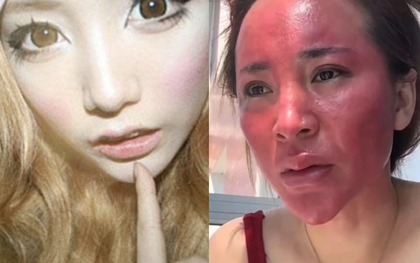 Những người phụ nữ makeup 24/7, không tẩy trang hơn 2 thập kỉ: Ai cũng nhận kết cục đắng?