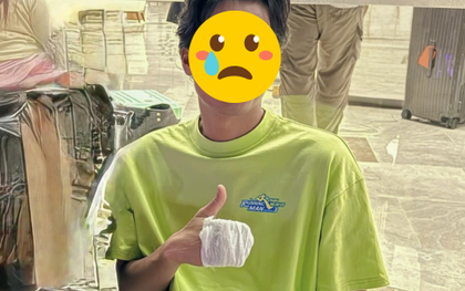 Thêm 1 thành viên Running Man Vietnam gặp tai nạn