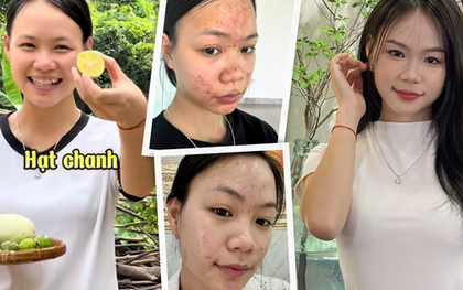 Da chi chít mụn do 5 năm rửa mặt sai cách, cô nàng chữa lành làn da bằng loại hạt mà mọi người vứt bỏ
