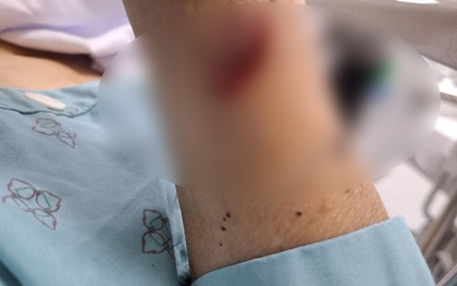 2 phụ nữ chém nhau bị thương nặng vì ghen tuông ở Thái Bình: Hé lộ tình trạng hôn nhân phức tạp