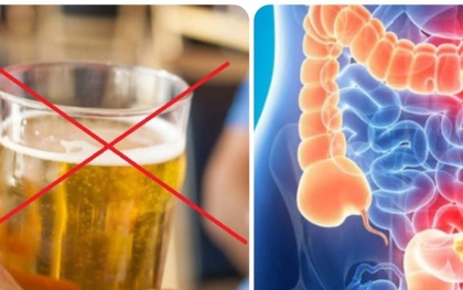 Bác sĩ chỉ cách phòng ngừa ung thư đại trực tràng
