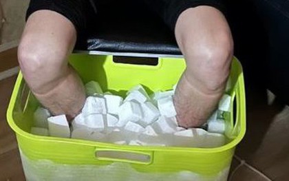 Nam sinh viên phải cắt cụt chân sau 10 tiếng ngâm đá khô, hé lộ âm mưu "động trời"