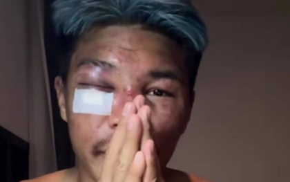 Bị võ sĩ châu Âu đánh sưng mặt, cao thủ Thái Lan chắp tay xin lỗi