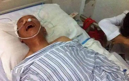 Ngày càng nhiều người tử vong vì nhồi máu não? Bác sĩ khuyên: Uống nước nóng còn hơn ăn 4 thứ này