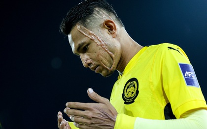 Tâm sự đau lòng của cầu thủ được ví như Ronaldo bị tạt axit gây rúng động: “Tôi không thể cười bình thường được nữa”