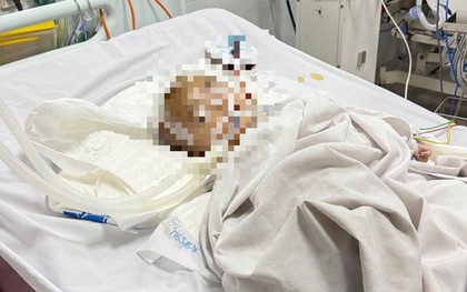 Bé trai xuất huyết não bất thường khi gửi ở nhóm nhà trẻ tự phát