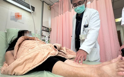 Người phụ nữ bị suy thận cấp sau khi đạp xe nhiều ngày