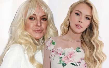 Màn "trẻ lại 10 năm" của Lindsay Lohan: Điều kỳ diệu sau làn da hết sạch dấu hiệu lão hóa tuổi 39