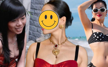 Phú bà Vbiz ở biệt thự hàng trăm tỷ suýt bị hoại tử vì phẫu thuật thẩm mỹ, phải huỷ show tháo sụn mũi gấp