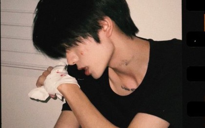 Trước khi xương bị "NUỐT CHỬNG" bởi ung thư, cơ thể sẽ báo cho bạn bằng 6 cách