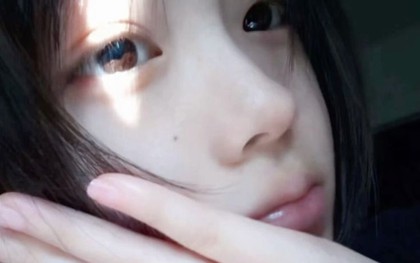 KIỂM TRA NGAY: Nốt ruồi mọc ở 6 vị trí này trên cơ thể rất dễ "biến hình" thành ung thư!