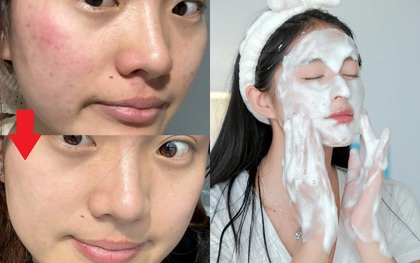 Thay đổi cách rửa mặt, lỗ chân lông của tôi nhỏ hẳn lại và da "đẹp lên trông thấy"
