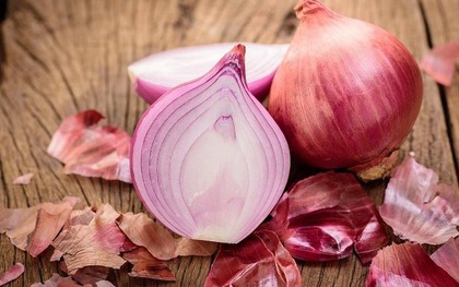 Sống mấy chục năm mới biết hành tây làm được 5 việc này, ai không biết thì rất thiệt