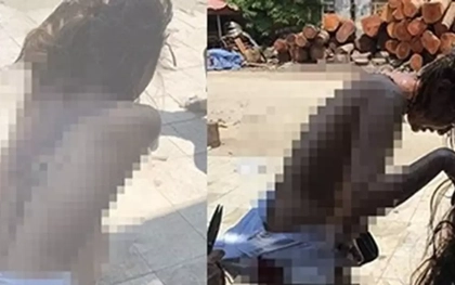 Truy tố nhóm đánh ghen nhầm gây thương tích 26% cho người khác