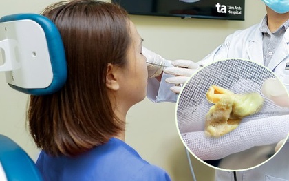 Thở thấy mùi hôi, người phụ nữ 31 tuổi ở TP.HCM phát hiện bị thẩm mỹ viện bỏ quên một thứ trong mũi suốt 1 tháng