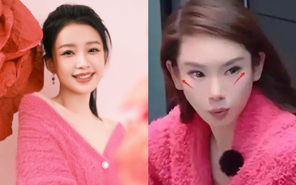 So sánh Tôn Di tuổi 32 và Thích Vy tuổi 41 liền nhận ra ngay sự "quá đà" trong việc can thiệp thẩm mỹ