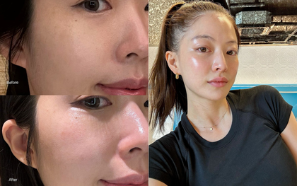 6 retinol chống già đỉnh như hack, bôi 1 phát bạn trẻ lại cỡ 5 tuổi xuân