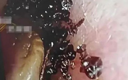 Bé gái 2 tuổi đi khám vì đau tai, bác sĩ phát hiện "bí mật đáng sợ"