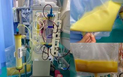 Máu trắng đục như sữa sau khi uống 3 cốc đồ uống này mỗi ngày: Nhiều người mê mẩn