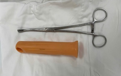 Cấp cứu nam thanh niên 23 tuổi ở TP.HCM bị kẹt cán cây lau nhà khoảng 15cm trong hậu môn