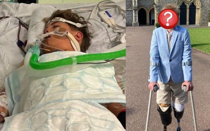 Bị chuột rút sau trại hè thể thao, cậu bé 13 tuổi phải cắt cụt 2 chân, cha mẹ lên tiếng cảnh báo