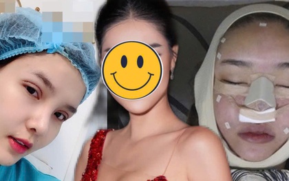Người mẫu Việt tự khui ảnh thẩm mỹ mặt, thừa nhận rơi khủng hoảng vì sợ biến dạng vĩnh viễn
