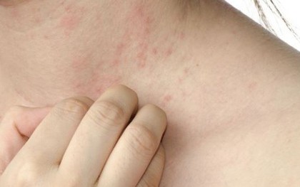 Đi khám vì bị ngứa khắp người, người phụ nữ sốc nặng trước thông báo của bác sĩ