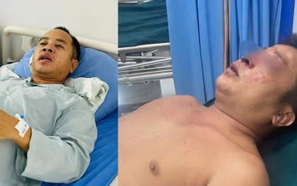 Sức khỏe 2 anh em bị hành hung khi giúp người đi đường gặp nạn giờ ra sao?