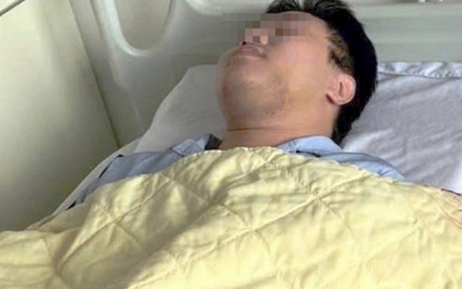 Chỉ vì 'ánh mắt', nam sinh Hà Nội bị đánh gãy xương hàm giữa ban ngày