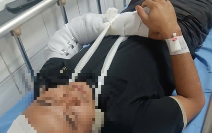 Nghi án tranh giành địa bàn cứu hộ, một tài xế bị đánh gãy tay