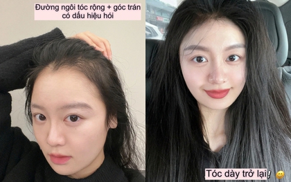 Tôi mất 5 năm để biến mái tóc thưa thớt trở nên dày dặn và bồng bềnh trở lại
