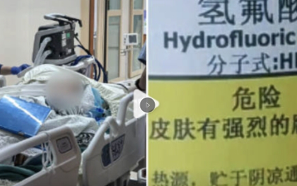 Giẫm phải ‘nước hòa tan xương’ khi đi dạo, người phụ nữ chết sau 5 ngày