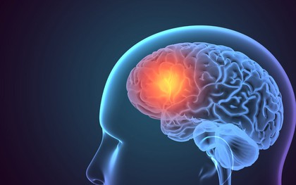 Huyết áp tăng vọt, đột quỵ "chực chờ" nếu lạm dụng 2 thứ này: Người Việt toàn dùng vượt mức khuyến cáo