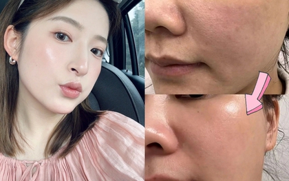 5 lọ serum tăng cường collagen rất cần cho phụ nữ ngoài 30 tuổi