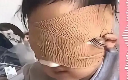 Bé gái 6 tuổi mất cả 2 mắt vì thứ nhiều bố mẹ vẫn cho con chơi mỗi ngày