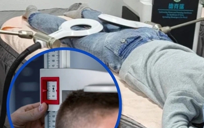 Chi tiền để cao hơn 1,4 cm, thiếu niên bất ngờ nhận 'trái đắng'