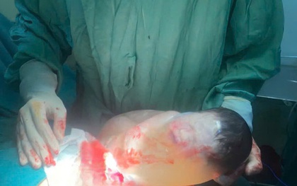 Khoảnh khắc hiếm gặp: Trẻ sơ sinh chào đời còn nguyên trong bọc ối