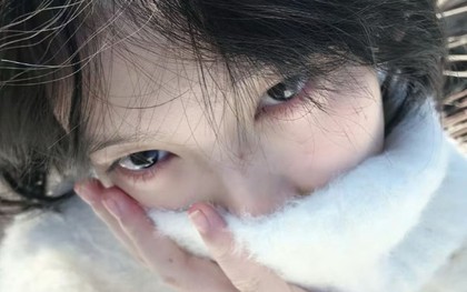 3 thay đổi ở mắt cho thấy máu đã "ngập mỡ", đi khám ngay còn kịp!