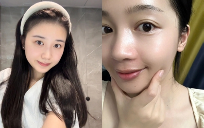 6 lọ acid toner là “khắc tinh” của da dầu mụn và lỗ chân lông to