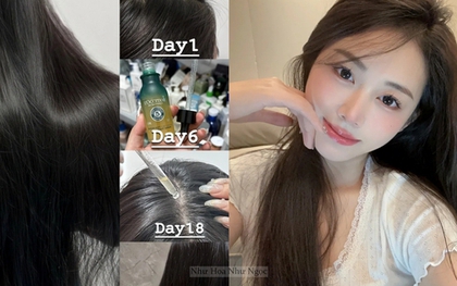 5 lọ serum "chân ái" cho hội rụng tóc, ngoài hiệu quả chống rụng thì còn giúp tóc bóng mướt từ chân
