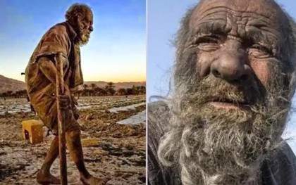 Vì sao "người đàn ông bẩn nhất thế giới" lại qua đời ngay sau khi tắm lần đầu tiên?