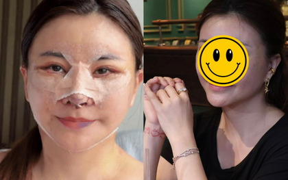Nữ diễn viên Việt vừa phẫu thuật thẩm mỹ mặt ở Hàn Quốc bị chê mạnh, phải vội lên tiếng làm rõ 1 thông tin