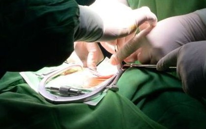 Sỏi đường tiết niệu ở trẻ em: Phát hiện muộn có thể gây suy thận