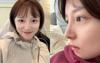 Công thức dưỡng da "2 nhiều - 1 ít" giúp tôi được khen trẻ như gái 18