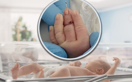 Cắt dây rốn, nữ hộ sinh vô tình cắt đứt ngón tay trẻ sơ sinh: Bé phải nối ngón, gia đình bàng hoàng