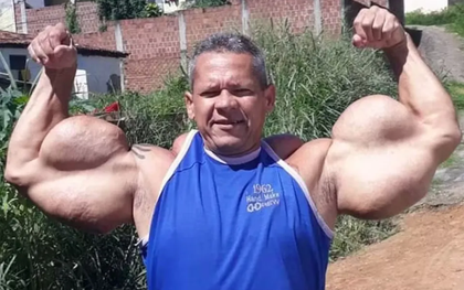 "Quái vật thể hình" Brazil sở hữu chu vi bắp tay lên tới 74cm đột ngột qua đời, bác sĩ cảnh báo 1 vấn đề sức khỏe tiềm ẩn