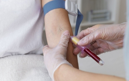 Phát hiện một phụ nữ mang nhóm máu cực hiếm, tỷ lệ 1/10.000