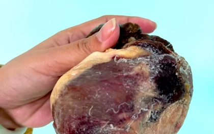 Mổ thịt con bò chỉ ngủ đứng, phát hiện vật thể nghi là ngưu hoàng quý hiếm