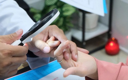 Da đỏ sậm, bong tróc khi trời lạnh, người phụ nữ Hà Nội phải cầu cứu bác sĩ